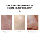 Salicylic Acid  For Acne Treatment, Anti-acne,  Shrink Pores, Moisturizing Serum Remove Blackheads Skin Care
