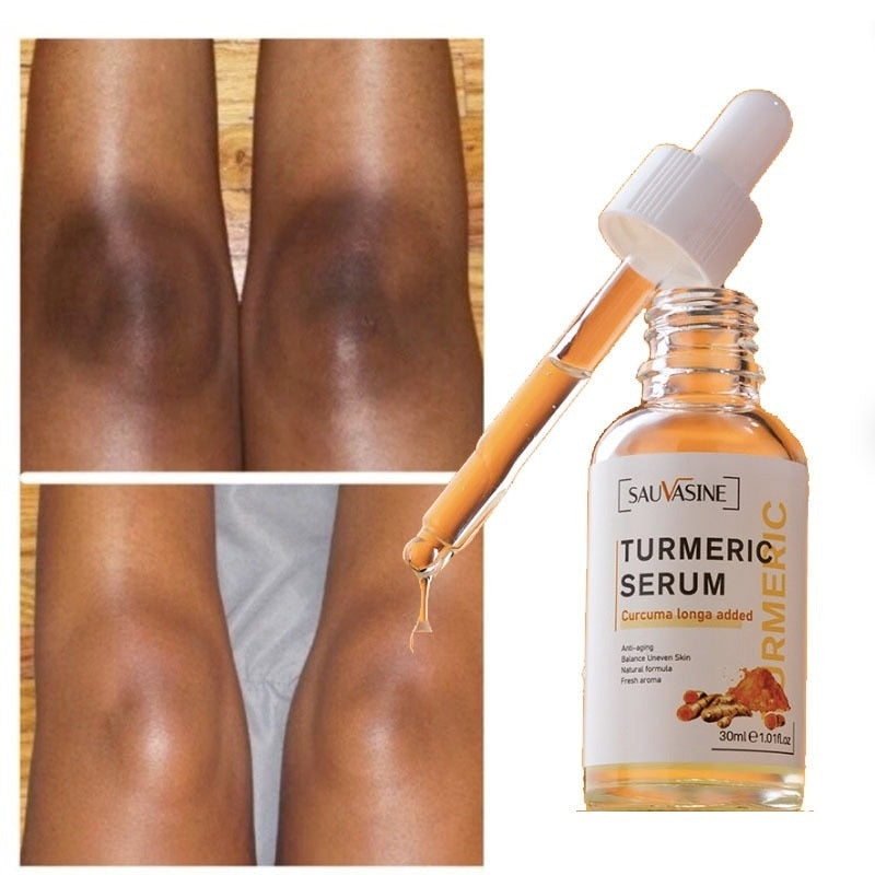 Turmeric Lemon Oil  For Skin Glow To Lightening Acne Dark Patches, Acne Bright Skin Dark Spot Corrector Face Whitening Serum