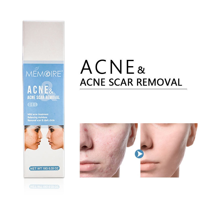 Herbal Acne Scar Removal Face Cream