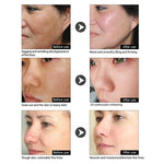 Vitamin C Whitening Face Serum  To Lighten Dark Spots Brightening Remove Freckle Speckle Acne Scars Esence Repair