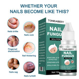 Nail Fungal Treatment Essence Oil