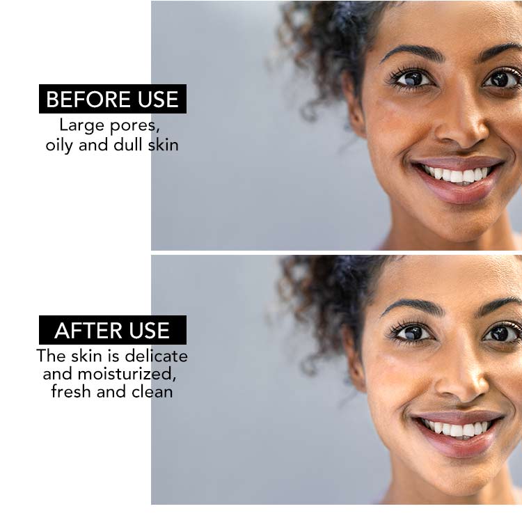 AILKE Whitening, Anti-Freckles Dark Spot Removal Face Cream