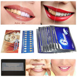 Teeth Whitening Strips (28Pcs)