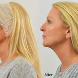 Thread Face Lift Anti Aging Essence Collagen