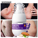 Skin Therapy Oil  For Removing Scars Stretch Marks Serum,  Moisturizing Nourish Improve Rough Smooth Fine Lines Lifting Firming Body Care