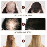 Pure Hair Growth Oil Spray