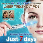Blue Light Pen For Acne, Varicose Veins, Wrinkle Removal
