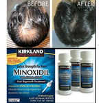 Minoxidl Fast Hair Growth Essence For Men
