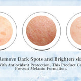 Effective Whitening Cream Anti-Freckle  Dark Spots Acne Scars Melanin Pigmentation Melasma Removal Cream