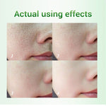 Green Tea Oil Control Pore Shrink Face Serum Whitening Remove Dark Spots Improve Acne Blackheads