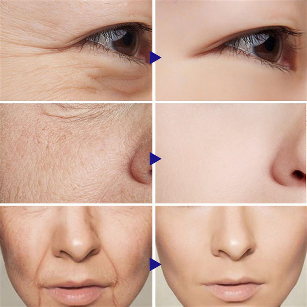 Facial Firming Wrinkle Remover Cream