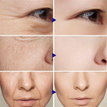 Facial Firming Wrinkle Remover Cream