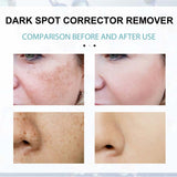 Nicotinamide Whitening Freckle  Dark Spot Remover Cream