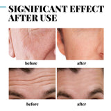 Mens Anti Wrinkle Anti Aging Face Collagen Cream