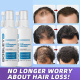 Fast Hair Growth Serum Spray For Men